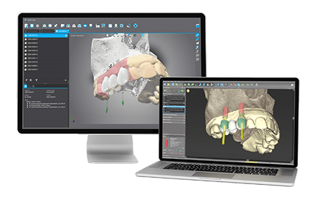 coDiagnostiX Software, XYZ Dental, Digital Dentistry, CAD-CAM Dentistry