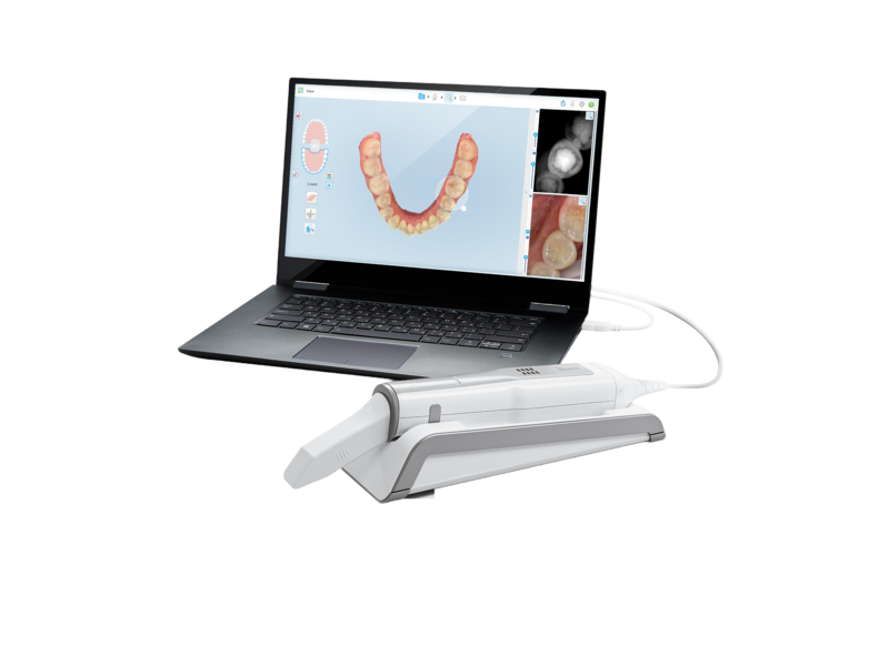 iTero Element™ 5D Laptop intraoral scanner