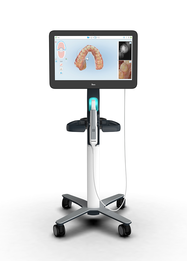 iTero Intraoral Scanner | XYZ Dental