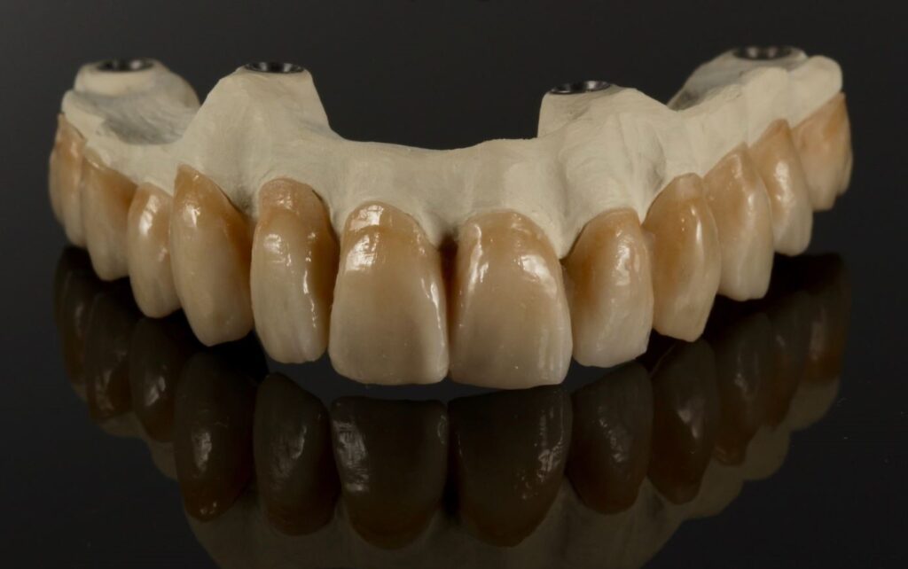 Whitepeaks Zirconia PEEK