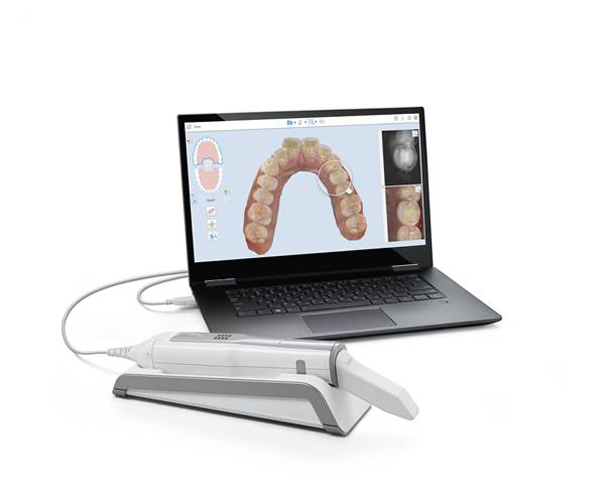 iTero Element 5D Laptop Configuration CPO