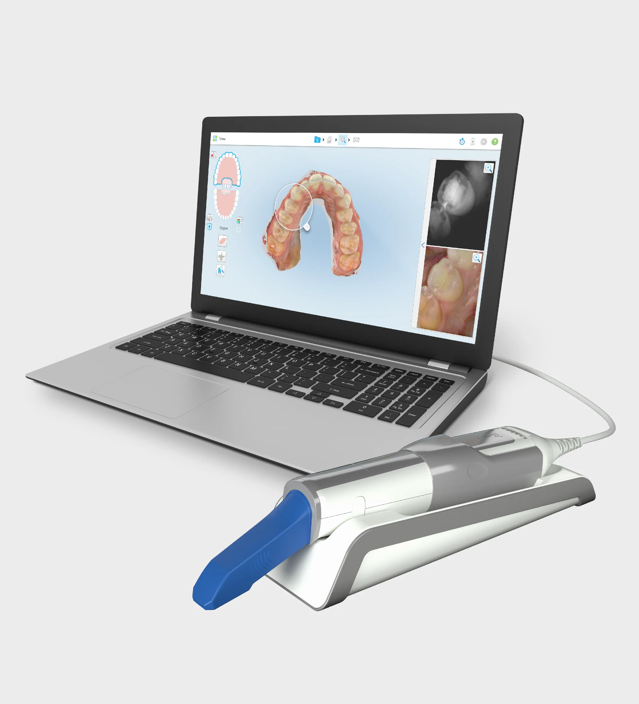 iTero Element 5D Laptop Configuration CPO - Image 2