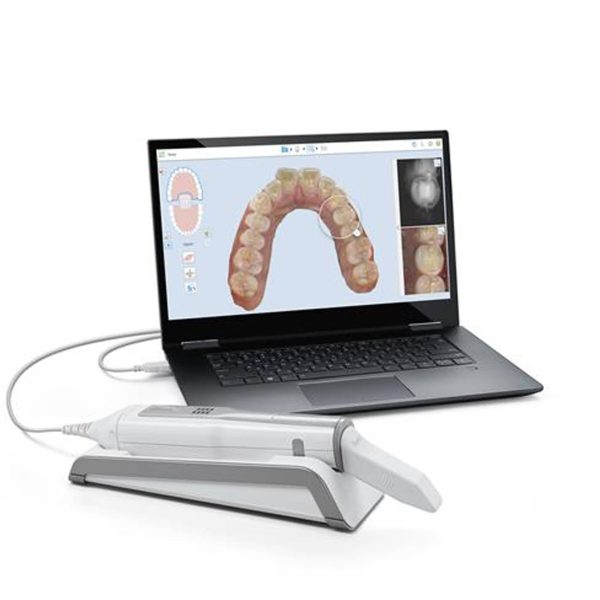 Align-Technology-iTero-Element-5D-Laptop-1