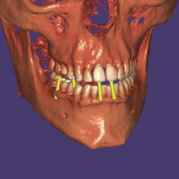 exocad DentalCAD Dicom viewer module