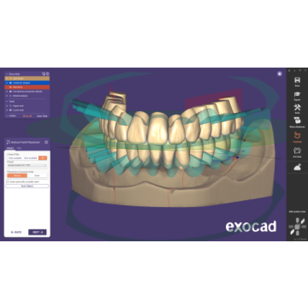 exocad DentalCAD Full Denture Ivotion Ivoclar add-on
