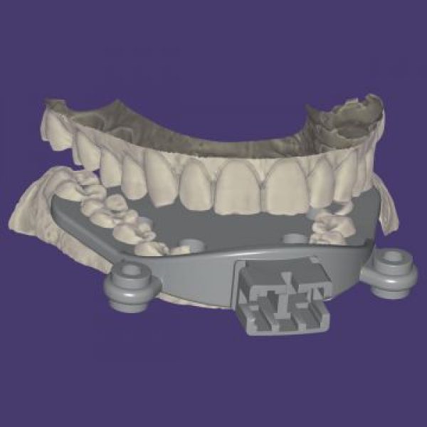exocad jaw motion import