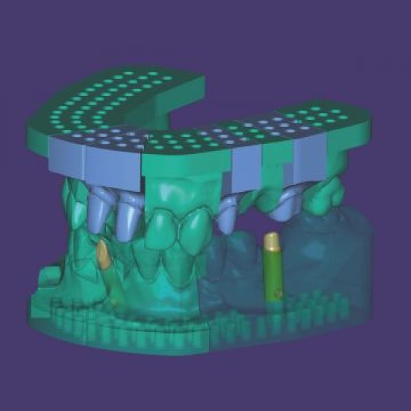 exocad Model Creator
