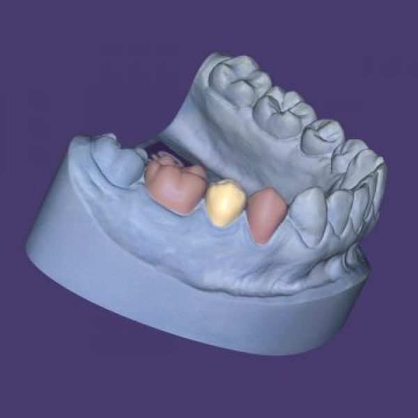 Provisional Module