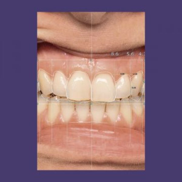 Smile Creator Module