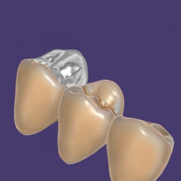 Trusmile Module