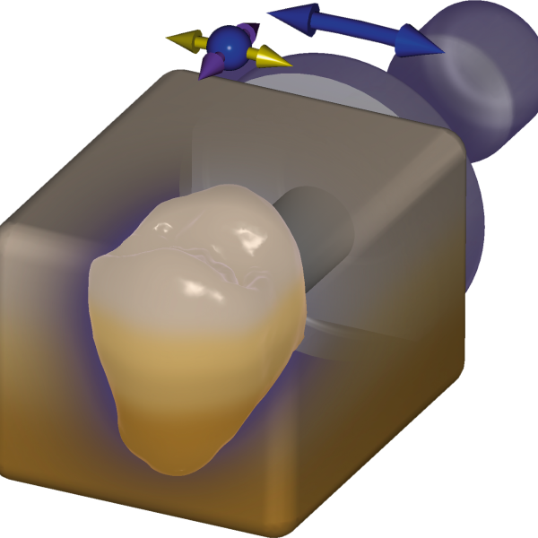 exocad in-cad nesting